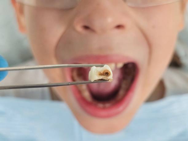 Best Chipped Tooth Repair Near Me  in St Clair Shores, MI